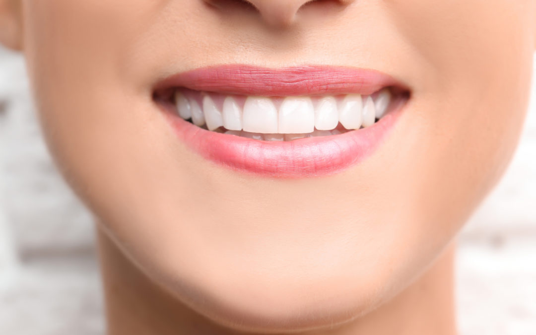 Dental Bonding, An Effective Teeth Treatment Procedure