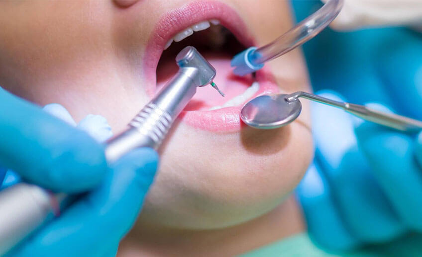 Reasons Why Summer Is the Best Time to Get a Dental Surgery