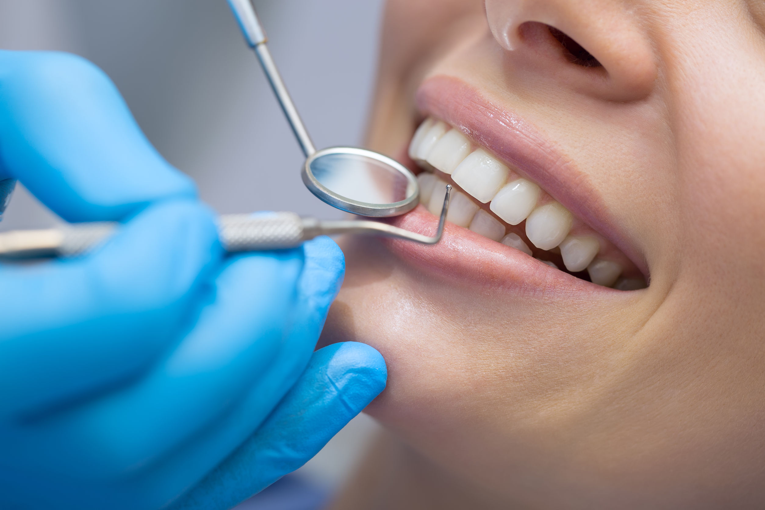 Dental Care: Restoring The Beauty of Your Smile Again
