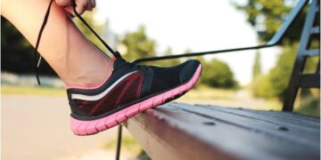 Varicose Veins