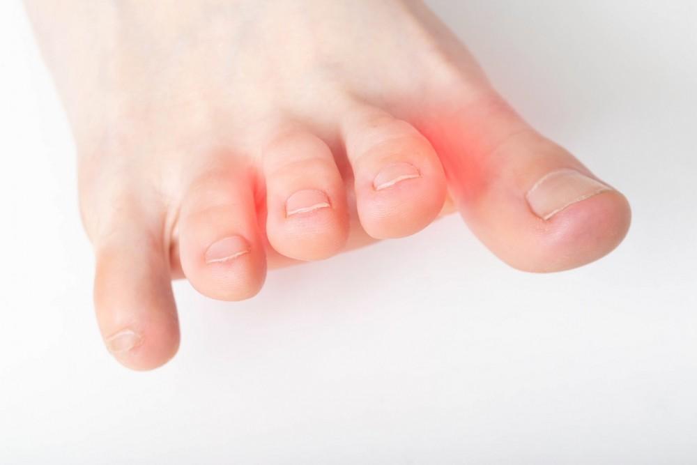 When a Simple Toe Pain Becomes Something More